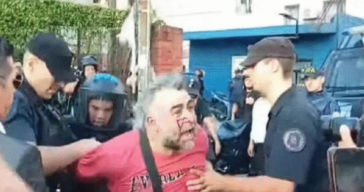 Ataque al camarógrafo: Bullrich admitió el pésimo accionar de la policía, pese a querer lavarse las manos